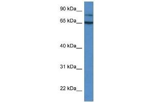 Western Blot showing IRAK2 antibody used at a concentration of 1 ug/ml against Fetal Liver Lysate (IRAK2 antibody  (C-Term))