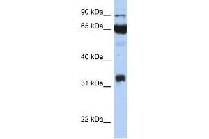 PTGS1 antibody used at 1 ug/ml to detect target protein. (PTGS1 antibody  (Middle Region))
