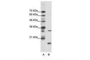 Image no. 1 for anti-MYC Associated Factor X (MAX) (C-Term) antibody (ABIN203016) (MAX antibody  (C-Term))