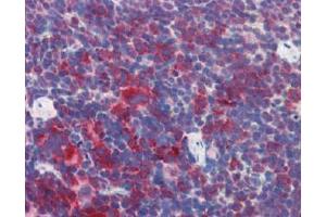 IHC Image for AP22588PU-N Mouse Spleen (formalin-fixed, paraffin-embedded) stained with M6PRBP1followed by biotinylated anti-goat IgG secondary antibody LS-D3, alkaline phosphatase-streptavidin and chromogen. (PLIN3 antibody  (Internal Region))