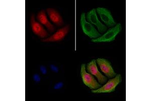 ABIN6255391 and ABIN6267252 staining Hela cells(4h of LPS treatment) by IF/ICC.