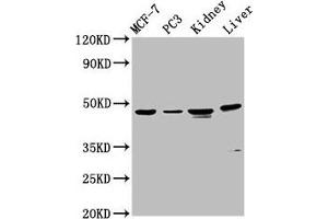 Western Blot Positive WB detected in: MCF-7 whole cell lysate, PC-3 whole cell lysate, Rat kidney tissue, Mouse liver tissue All lanes: HPN antibody at 4. (Hepsin antibody  (AA 294-413))