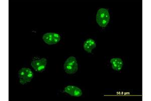 Immunofluorescence of monoclonal antibody to FBL on HeLa cell. (Fibrillarin antibody  (AA 1-321))
