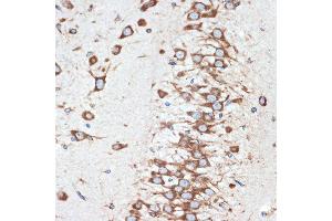 Immunohistochemistry of paraffin-embedded rat brain using LM Rabbit mAb (ABIN7268205) at dilution of 1:100 (40x lens). (LMAN1 antibody)
