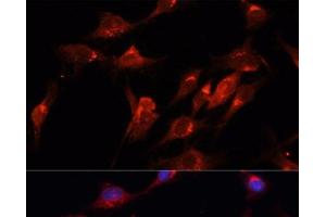 Immunofluorescence analysis of C6 cells using CUX1 Polyclonal Antibody at dilution of 1:100. (CUX1 antibody)