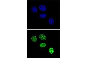Confocal immunofluorescent analysis of PCNA Antibody (C-term) (ABIN389344 and ABIN2839453) with Hela cell followed by Alexa Fluor 488-conjugated goat anti-rabbit lgG (green). (PCNA antibody  (C-Term))