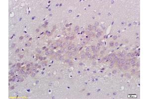 Formalin-fixed and paraffin embedded rat brain labeled with Anti PABP Polyclonal Antibody, Unconjugated (ABIN704786) at 1:200 followed by conjugation to the secondary antibody and DAB staining