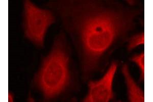 Immunofluorescence staining of methanol-fixed Hela cells using eIF2a(phospho-Ser49) Antibody. (EIF2S1 antibody  (pSer49))