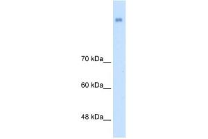 WB Suggested Anti-NRCAM Antibody Titration:  2. (NrCAM antibody  (N-Term))