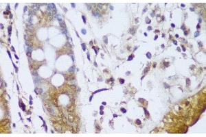 Immunohistochemistry of paraffin-embedded Human colon using GCC2 Polyclonal Antibody at dilution of 1:150 (40x lens).