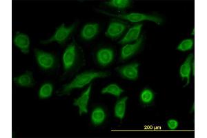 Immunofluorescence of monoclonal antibody to TIMP2 on HeLa cell. (TIMP2 antibody  (AA 27-220))