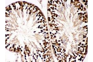 IHC-P: PBK antibody testing of mouse testis tissue