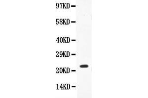Anti-IL-18 Picoband antibody, All lanes: Anti-IL18  at 0.