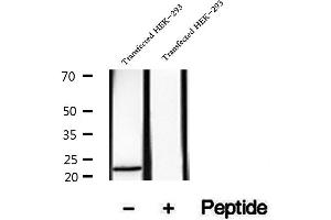 Western blot analysis of extracts of MCF-7 cells, using HBXIP antibody.