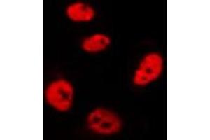 ABIN6275797 staining Hela by IF/ICC. (CHFR antibody)