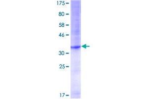 POT1 Protein (AA 1-95) (GST tag)