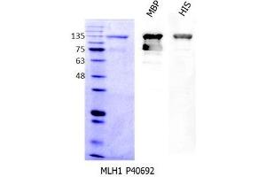 Western Blotting (WB) image for Myeloproliferative Leukemia Virus Oncogene (MPL) (AA 26-635) protein (MBP tag,His tag) (ABIN3074645) (MPL Protein (AA 26-635) (MBP tag,His tag))