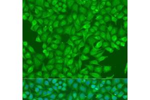 Immunofluorescence analysis of U2OS cells using CBL Polyclonal Antibody at dilution of 1:100.