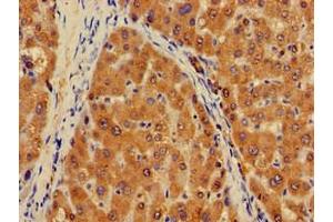 Immunohistochemistry of paraffin-embedded human liver tissue using ABIN7163717 at dilution of 1:100 (PLXND1 antibody  (AA 1-222))