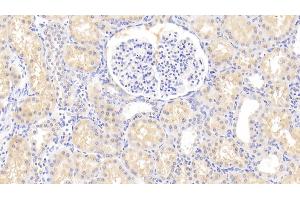 Detection of HLA-DRA in Human Kidney Tissue using Polyclonal Antibody to HLA Class II Histocompatibility Antigen, DR Alpha Chain (HLA-DRA) (HLA-DRA antibody  (AA 27-216))