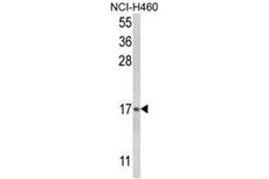 Western blot analysis of LTC4S Antibody (LTC4S antibody  (N-Term))