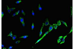 Immunofluorescent analysis of Hela cells using ABIN7169449 at dilution of 1:100 and Alexa Fluor 488-congugated AffiniPure Goat Anti-Rabbit IgG(H+L) (SH2D1A antibody  (AA 11-124))