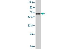 Western Blot detection against Immunogen (57. (AKTIP antibody  (AA 1-292))