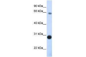 DERL3 antibody used at 1 ug/ml to detect target protein. (Derlin-3 antibody  (C-Term))