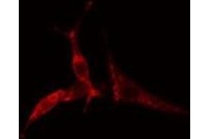 ABIN6275186 staining  COLO205 cells by IF/ICC. (HLA-DOA antibody)