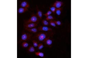 IF analysis of FBP1 using anti-FBP1 antibody (ABIN7599395). (FBP1 antibody  (AA 1-44))