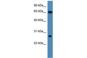 Image no. 1 for anti-Kelch Repeat and BTB (POZ) Domain Containing 8 (KBTBD8) (AA 63-112) antibody (ABIN6746791) (KBTBD8 antibody  (AA 63-112))