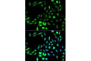 Immunofluorescence analysis of MCF-7 cells using KPNA2 antibody. (KPNA2 antibody  (AA 1-290))