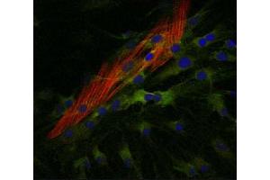 Human myofibroblasts were stained with anti-COX2 and anti-α-SMA followed by Goat Anti-Mouse IgG2a, Human ads-TXRD (Goat anti-Mouse IgG1 (Heavy Chain) Antibody (FITC))
