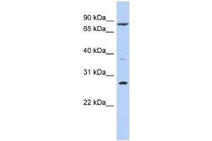 Western Blot showing KLF12 antibody used at a concentration of 1-2 ug/ml to detect its target protein. (KLF12 antibody  (N-Term))