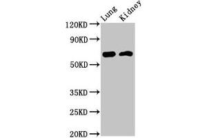 Western Blot Positive WB detected in: Rat lung tissue, Mouse kidney tissue All lanes: IQCB1 antibody at 3. (IQCB1 antibody  (AA 445-598))