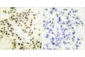 Peptide - +Immunohistochemical analysis of paraffin-embedded human breast carcinoma tissue using DNA-PK antibody. (PRKDC antibody)