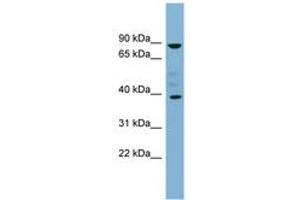 Image no. 1 for anti-Membrane-Associated Ring Finger (C3HC4) 8, E3 Ubiquitin Protein Ligase (MARCH8) (C-Term) antibody (ABIN6743135) (MARCH8 antibody  (C-Term))