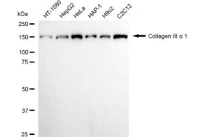 Western blotting analysis using collagen III alpha 1 antibody (ABIN7798125).