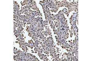 IHC analysis of HOXC4 using anti-HOXC4 antibody (ABIN7603059). (HOXC4 antibody  (Middle Region))