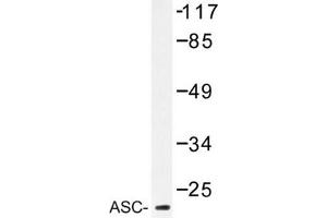 Image no. 2 for anti-PYD and CARD Domain Containing (PYCARD) antibody (ABIN272291) (PYCARD antibody)