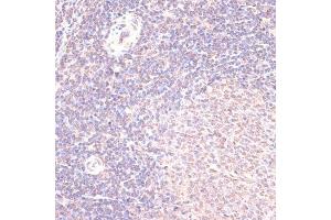 Immunohistochemistry of paraffin-embedded rat spleen using HSF1 antibody (ABIN6131141, ABIN6142021, ABIN6142022 and ABIN6217875) at dilution of 1:100 (40x lens). (HSF1 antibody  (AA 350-529))