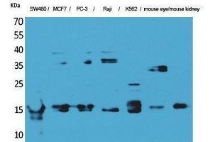 Western Blotting (WB) image for anti-MK (Internal Region) antibody (ABIN3180994) (MK (Internal Region) antibody)