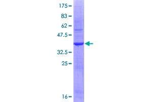 Image no. 1 for Interleukin 1 alpha (IL1A) (AA 172-271) protein (GST tag) (ABIN1307736) (IL1A Protein (AA 172-271) (GST tag))