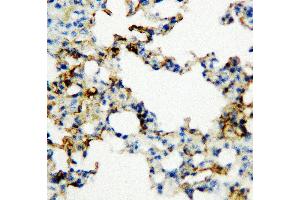 Anti-RAGE antibody, IHC(P) IHC(P): Rat Lung Tissue (RAGE antibody  (Middle Region))