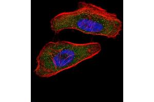 Fluorescent confocal image of Hela cell stained with HIF1A Antibody (N-term) (ABIN650972 and ABIN2840017). (HIF1A antibody  (N-Term))