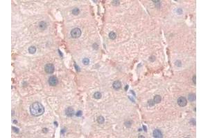 DAB staining on IHC-P; Samples: Human Liver Tissue (SFRP4 antibody  (AA 25-222))