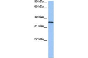 Western Blotting (WB) image for anti-Heterogeneous Nuclear Ribonucleoprotein A2/B1 (HNRNPA2B1) antibody (ABIN2462310)