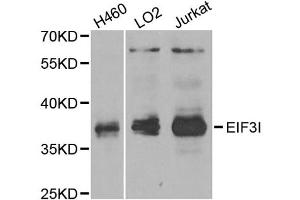Western blot analysis of extracts of various cell lines, using EIF3I antibody (ABIN2562390) at 1:1000 dilution. (EIF3I antibody)
