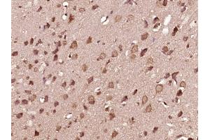 Paraformaldehyde-fixed, paraffin embedded Rat brain Antigen retrieval by boiling in sodium citrate buffer (pH6. (MEK1 antibody  (pThr286))