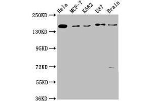 Western Blot Positive WB detected in: Hela whole cell lysate, MCF-7 whole cell lysate, K562 whole cell lysate, U87 whole cell lysate, Rat brain tissue All lanes: RAD54L2 antibody at 3.